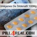 Imágenes De Sildenafil 100Mg 44